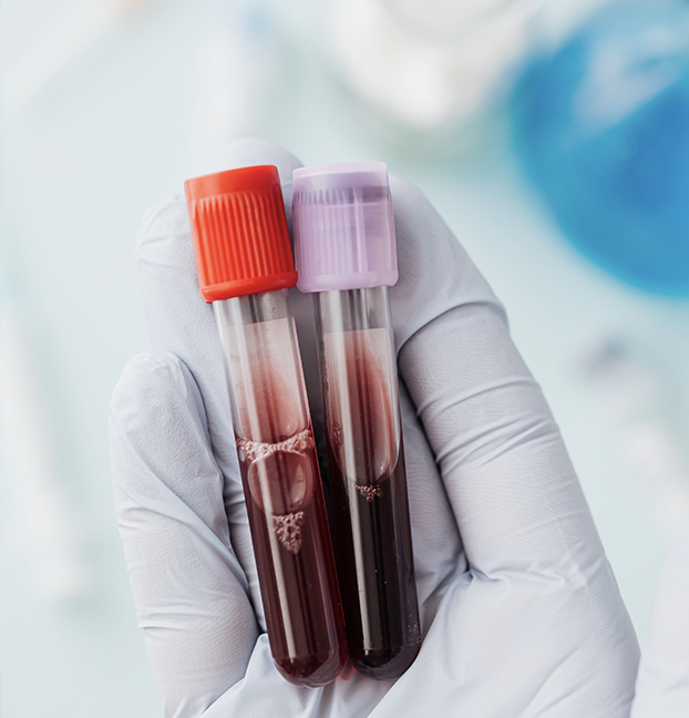 Blood test Aberdeen
