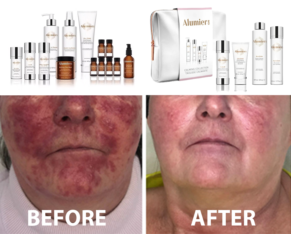 AlumierMD_opulent_health Aberdeen